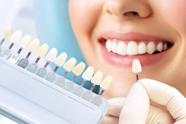 Best Smile design treatment in Muzaffarnagar