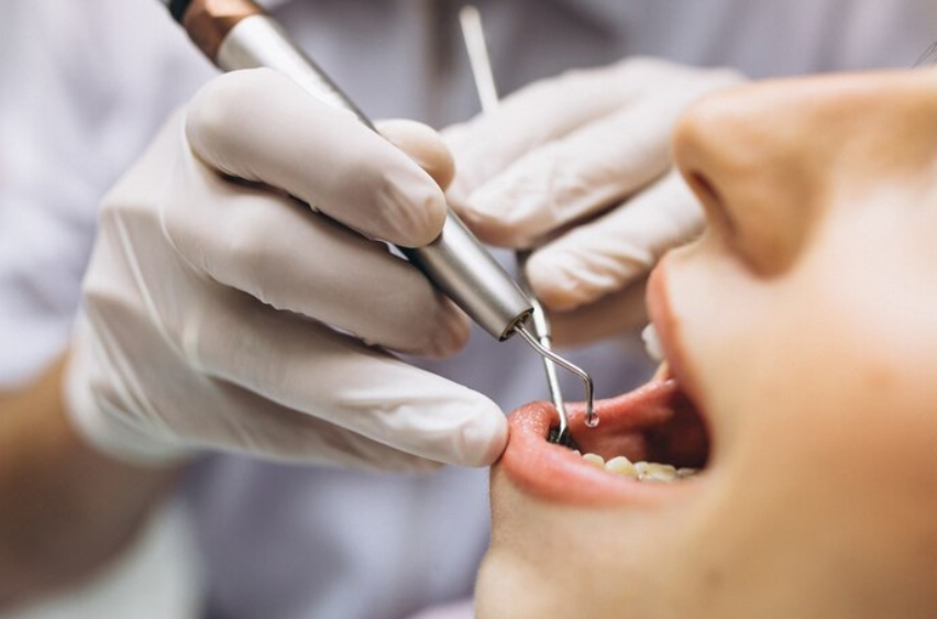 Best Restorative dentist in Muzaffarnagar