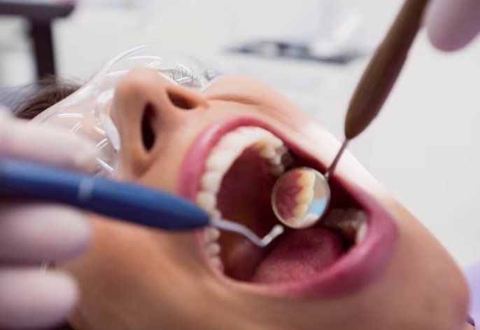 best dental filling service in Muzaffarnagar