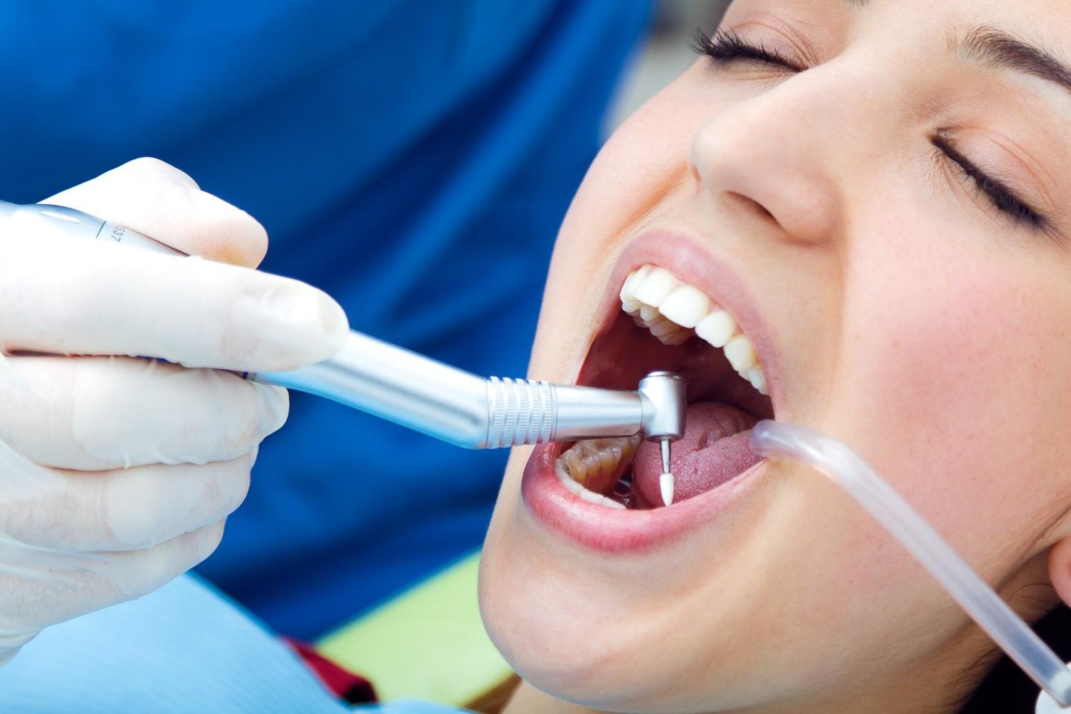 Best Dental Fillings Doctor in Muzaffarnagar