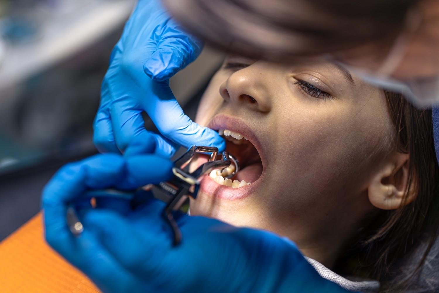 Best Orthodontic Specialist in Muzaffarnagar
