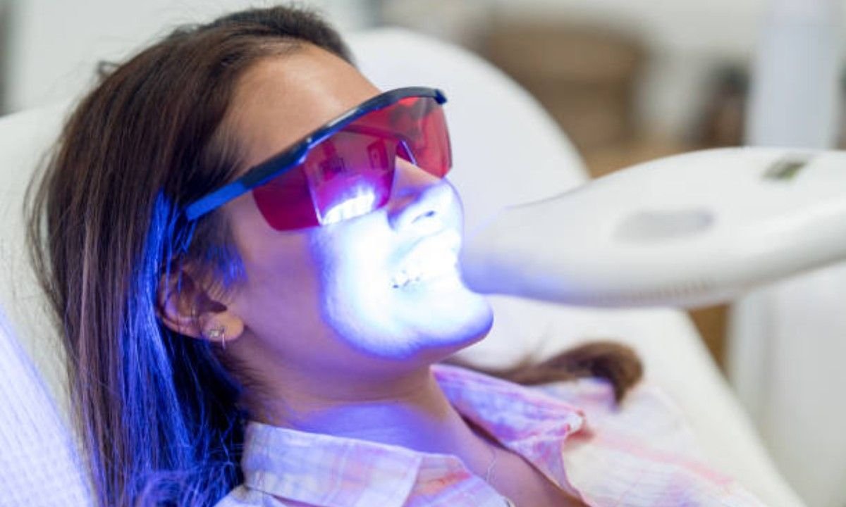 Best Teeth Whitening in Dehradun
