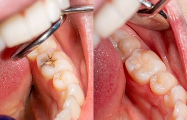 326534b1f4aa0b4c887636e225f52ef7