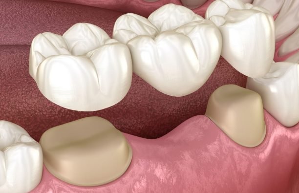 79716869e87efc171e437ac0943698f7